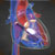 心臓刺激伝導系